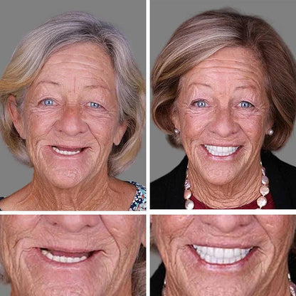 Limited-time sale is about to end! ⏰Pryxo™ Medical Full Denture with Strong Suctiond🦷Obtain American Dental Association (ADA) Certification