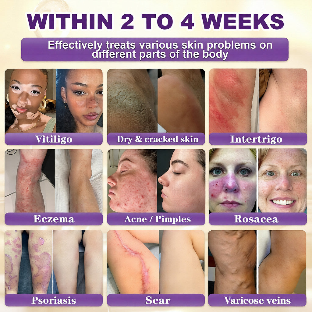 Made and Shipped from USA ✨Virexo™ Biotin 10-in-1 Skin Restoration Cream 🍀