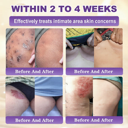 Made and Shipped from USA ✨Virexo™ Biotin 10-in-1 Skin Restoration Cream 🍀