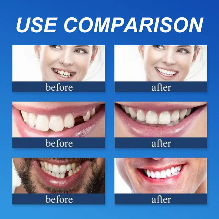 Limited-time sale is about to end! ⏰Pryxo™ Medical Full Denture with Strong Suctiond🦷Obtain American Dental Association (ADA) Certification