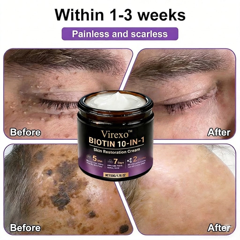 Made and Shipped from USA ✨Virexo™ Biotin 10-in-1 Skin Restoration Cream 🍀