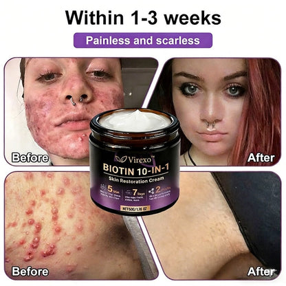 Made and Shipped from USA ✨Virexo™ Biotin 10-in-1 Skin Restoration Cream 🍀