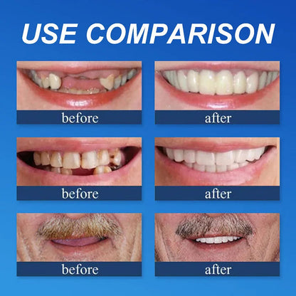 Limited-time sale is about to end! ⏰Pryxo™ Medical Full Denture with Strong Suctiond🦷Obtain American Dental Association (ADA) Certification