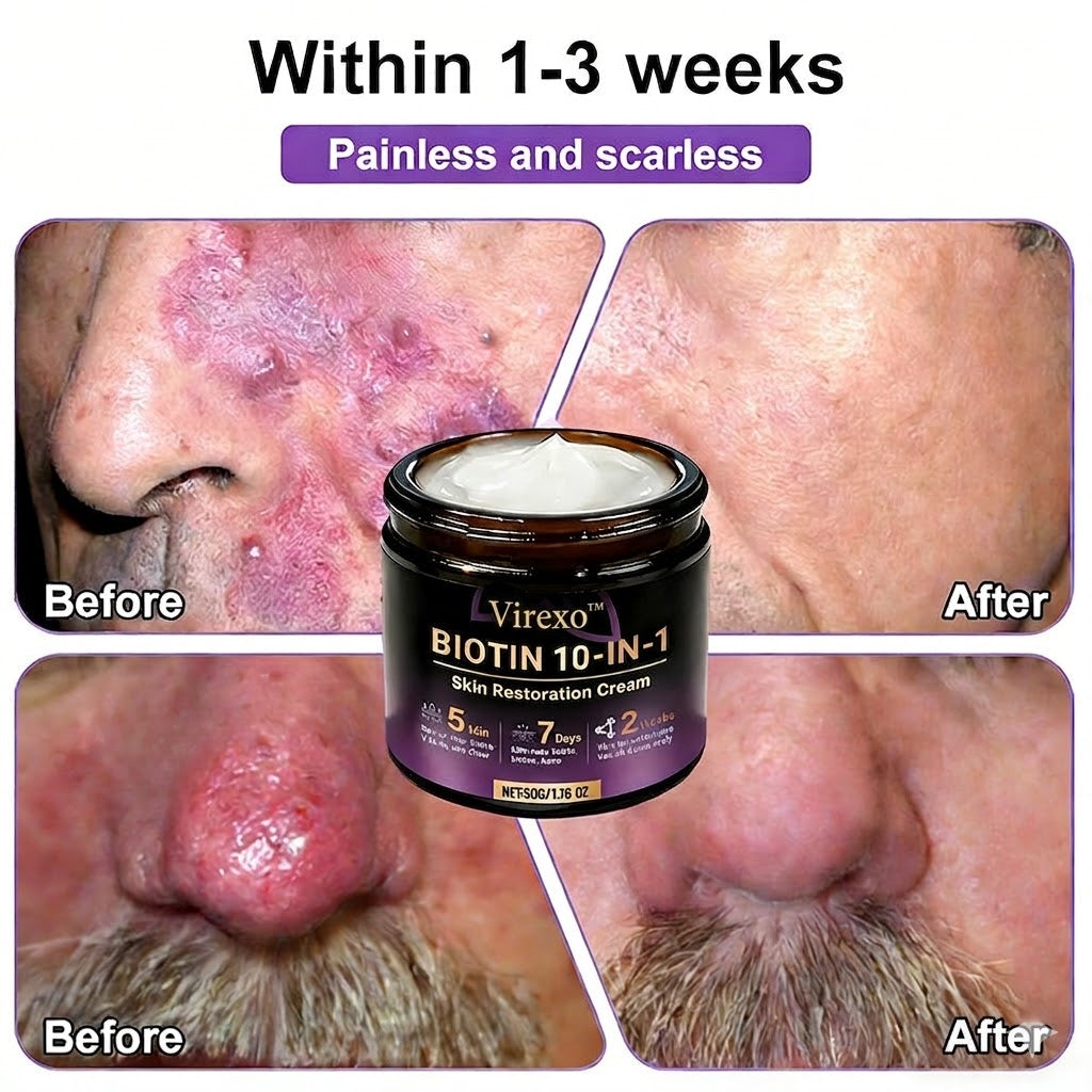 Made and Shipped from USA ✨Virexo™ Biotin 10-in-1 Skin Restoration Cream 🍀