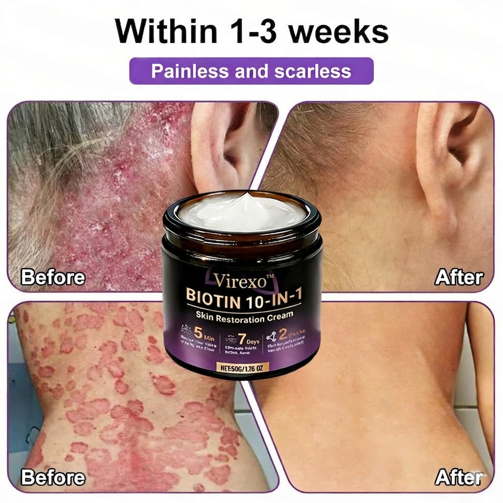 Made and Shipped from USA ✨Virexo™ Biotin 10-in-1 Skin Restoration Cream 🍀