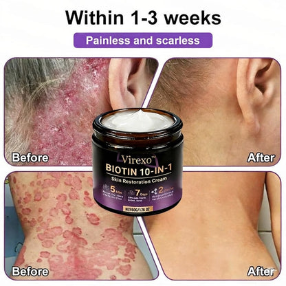 Made and Shipped from USA ✨Virexo™ Biotin 10-in-1 Skin Restoration Cream 🍀